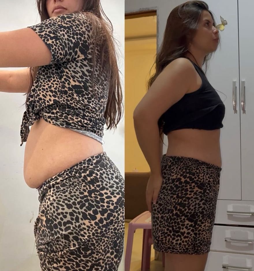 Resultado Antes e Depois 2