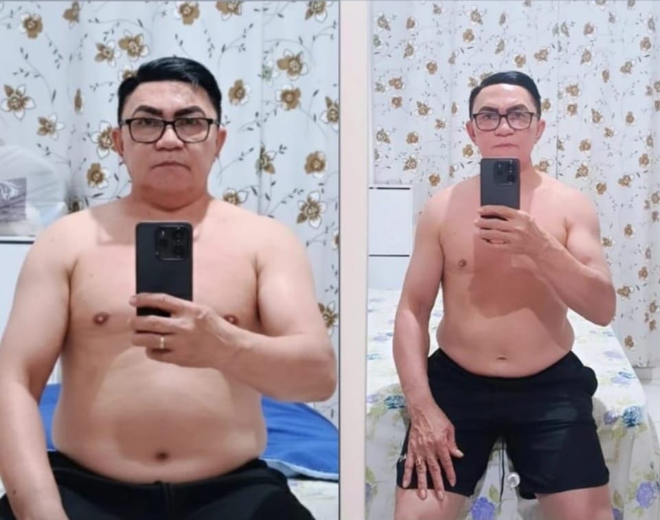 Resultado Antes e Depois 5