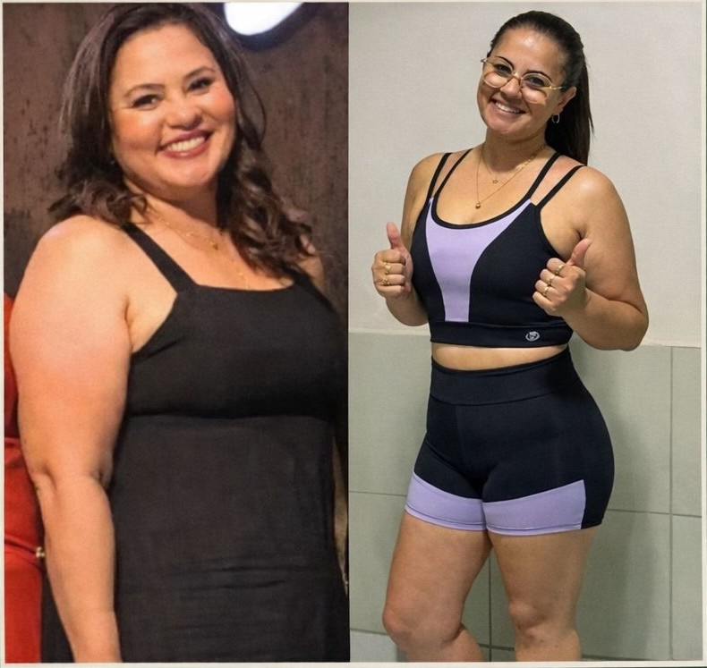 Resultado Antes e Depois 6