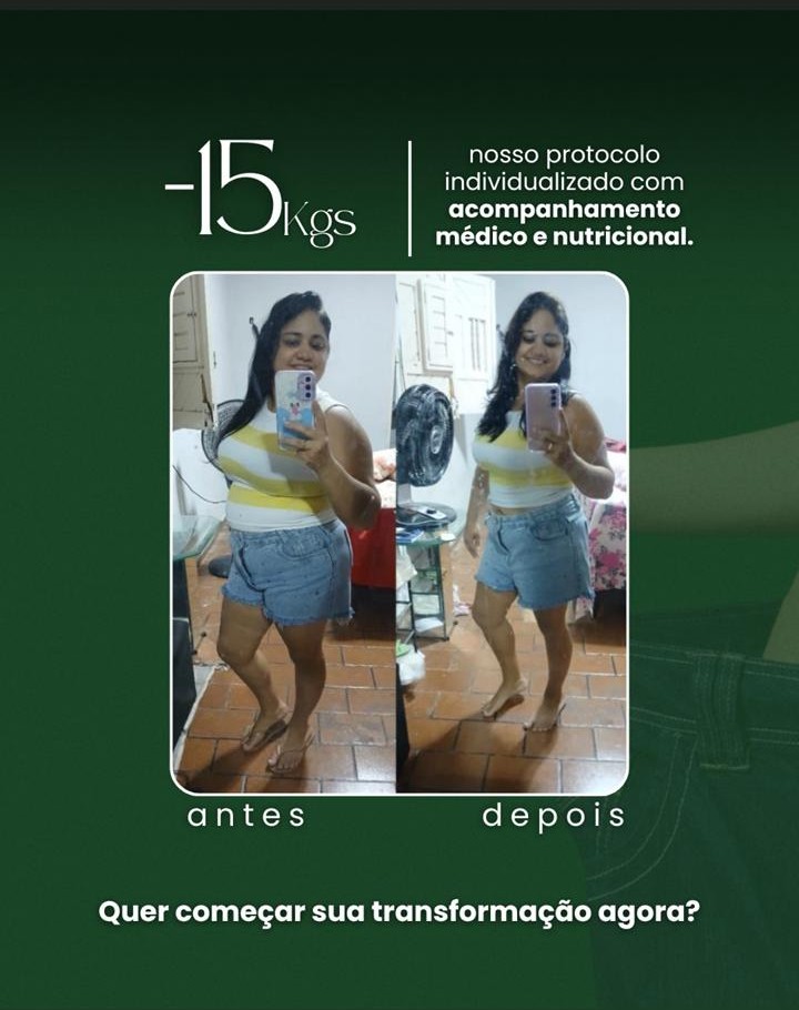 Resultado Antes e Depois 7