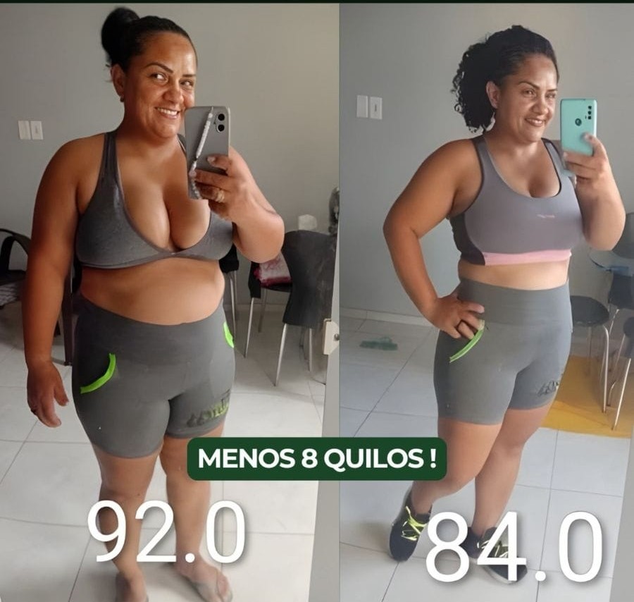 Resultado Antes e Depois 8